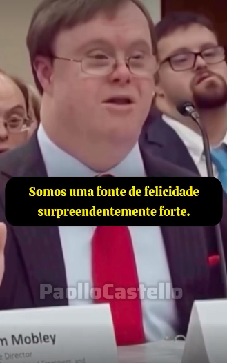 Como é a vida com síndrome de Down